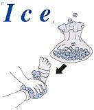 ICE