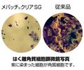 【はく離角質細胞顕微鏡写真】紫に染まった細胞が角質細胞です。