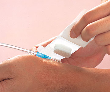 ステプティ&reg;Pの使用例