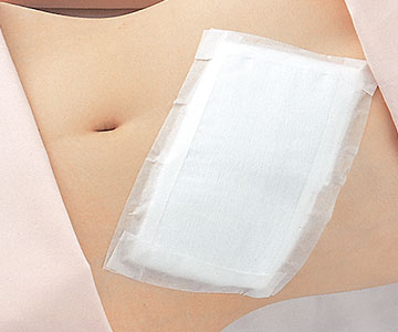 サージカルテープ-21Nの使用例1