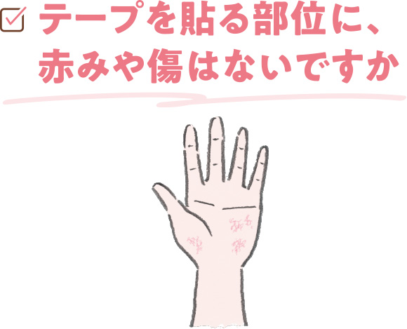 テープを貼る部位に、赤みや傷はないですか