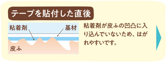 テープを貼付した直後 粘着剤が皮ふの凹凸に入り込んでいないため、はがれやすいです。