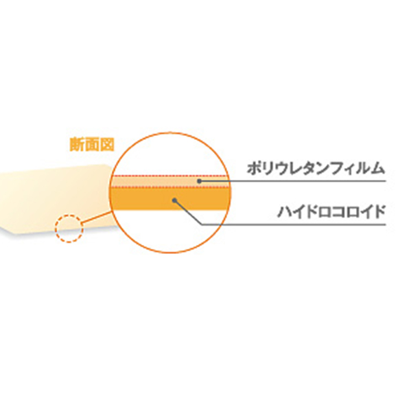 ハイコロール™断面図