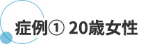 症例 ① 20歳女性