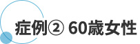 症例 ② 60歳女性