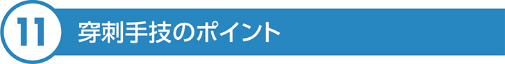 穿刺手技のポイント