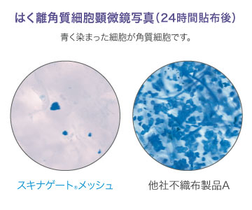はく離角質細胞顕微鏡写真(24時間貼付後)青く染まった細胞が角質細胞です。