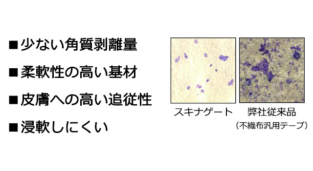 少ない角質剥離量／柔軟性の高い基材／皮膚への高い追従性／浸軟しにくい：弊社従来品（不織布汎用テープ）との比較